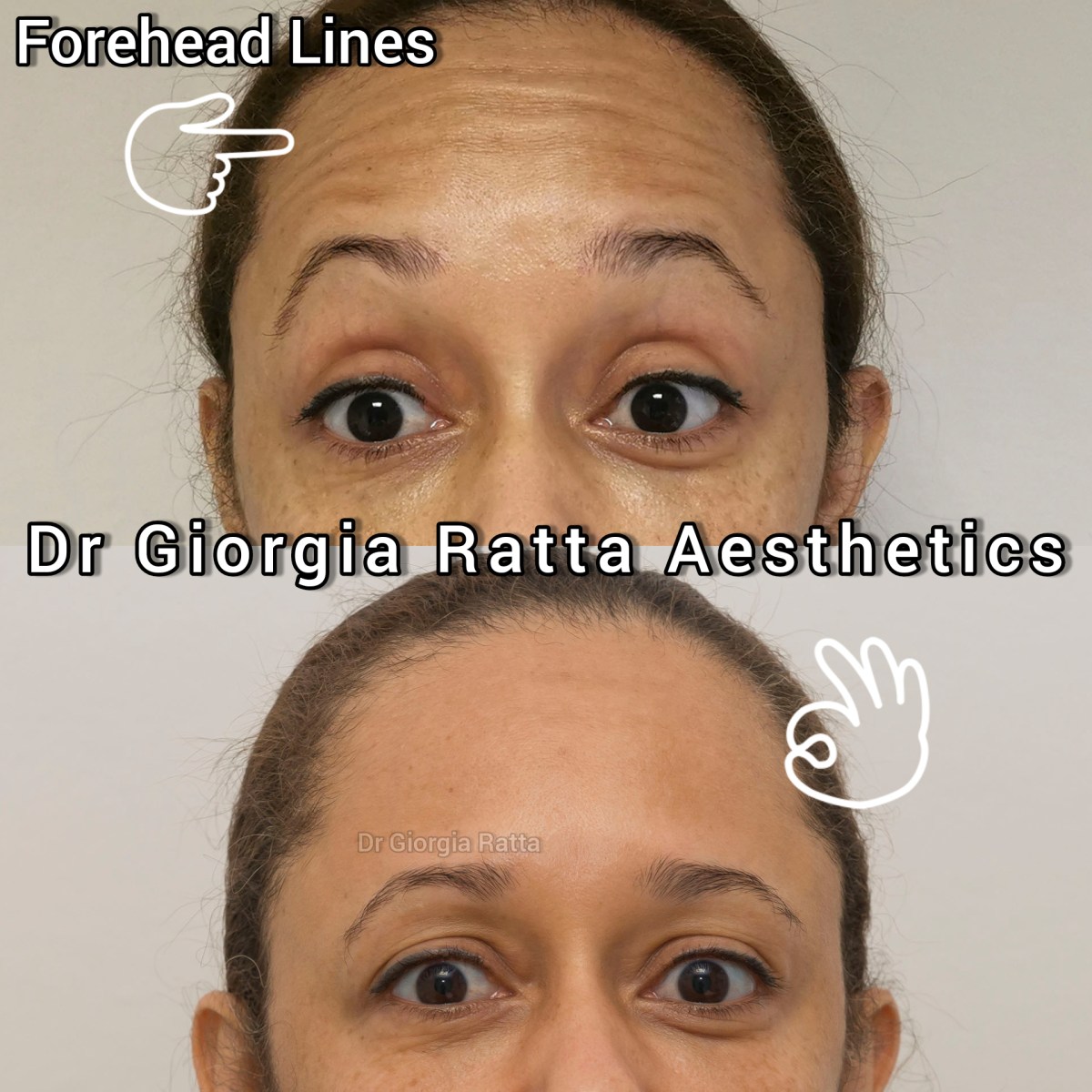 Dr Giorgia Ratta - before and after treatment image