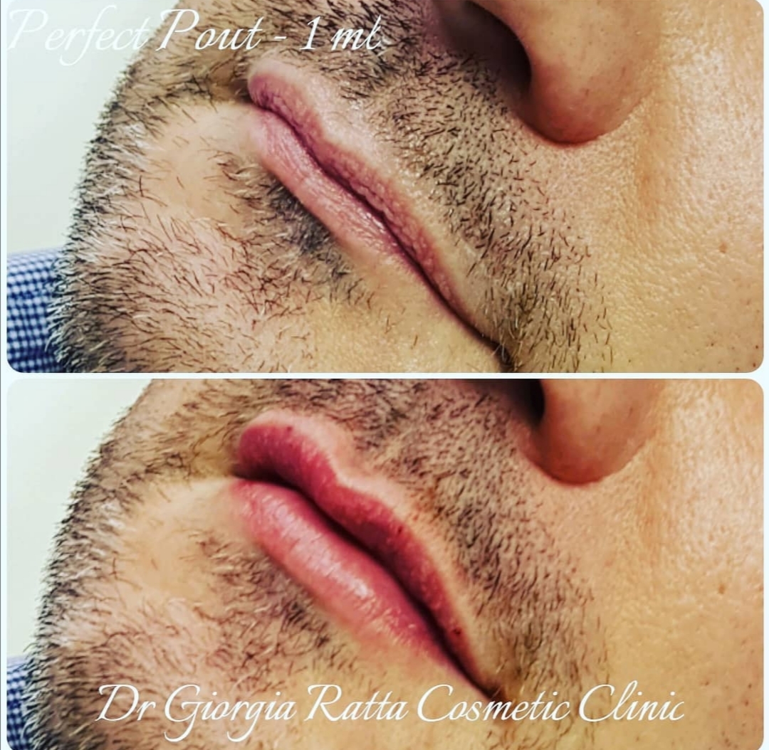 Dr Giorgia Ratta - before and after treatment image