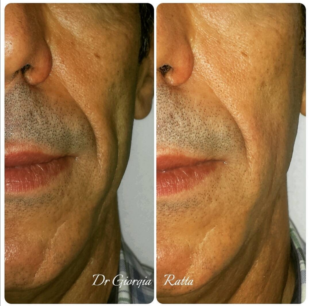 Dr Giorgia Ratta - before and after treatment image