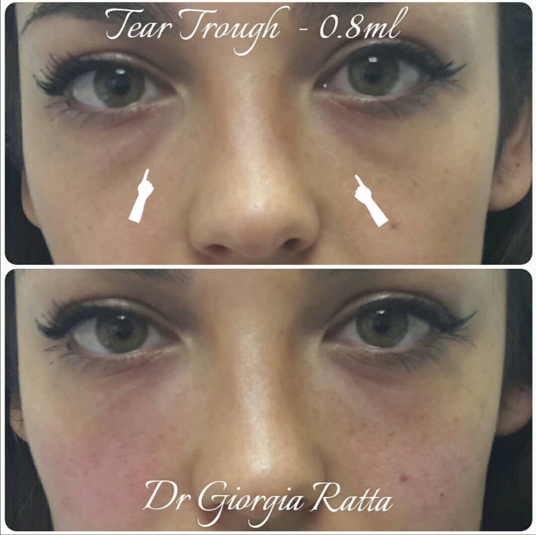 Dr Giorgia Ratta - before and after treatment image
